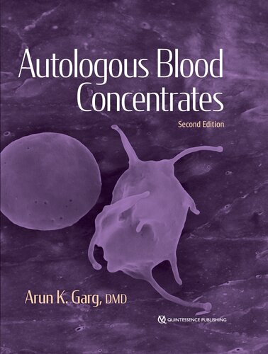 Autulogous Blood Concentrates (PDF/EPUB Version)
