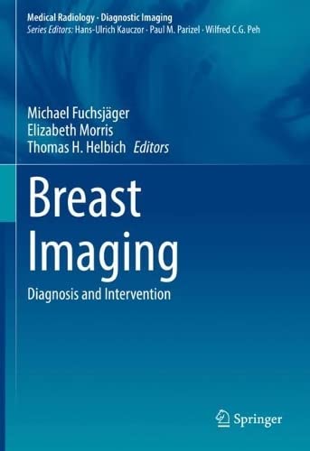 Breast Imaging: Diagnosis and Intervention (PDF/EPUB Version)
