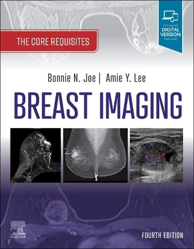Breast Imaging: The Core Requisites (PDF/EPUB Version)