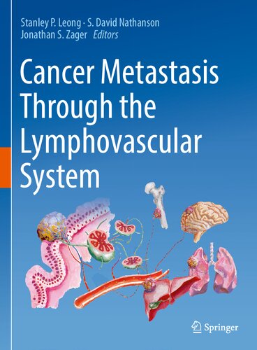 Cancer Metastasis Through the Lymphovascular System (PDF/EPUB Version)