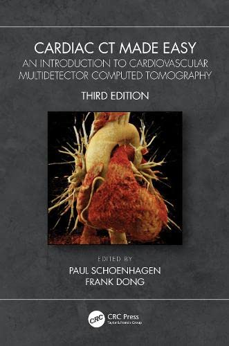 Cardiac Ct Made Easy: An Introduction to Cardiovascular Multidetector Computed Tomography (PDF/EPUB Version)