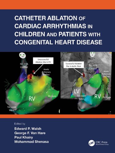 Catheter Ablation of Cardiac Arrhythmias in Children and Patients with Congenital Heart Disease (PDF/EPUB Version)