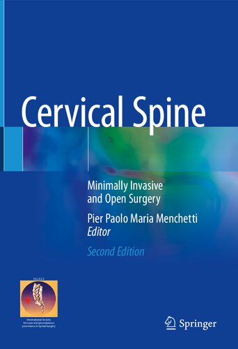 Cervical spine : minimally invasive and open surgery (PDF/EPUB Version)