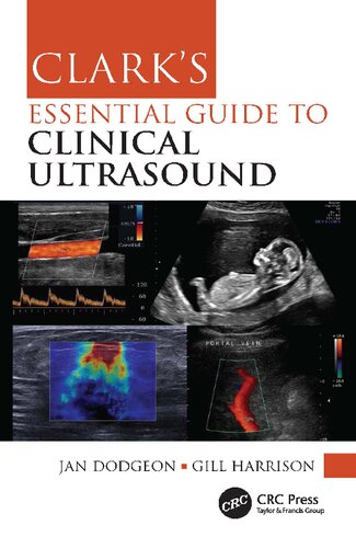 Clark's Essential Guide to Clinical Ultrasound (PDF/EPUB Version)