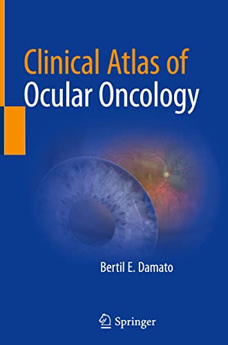 Clinical Atlas of Ocular Oncology (PDF/EPUB Version)