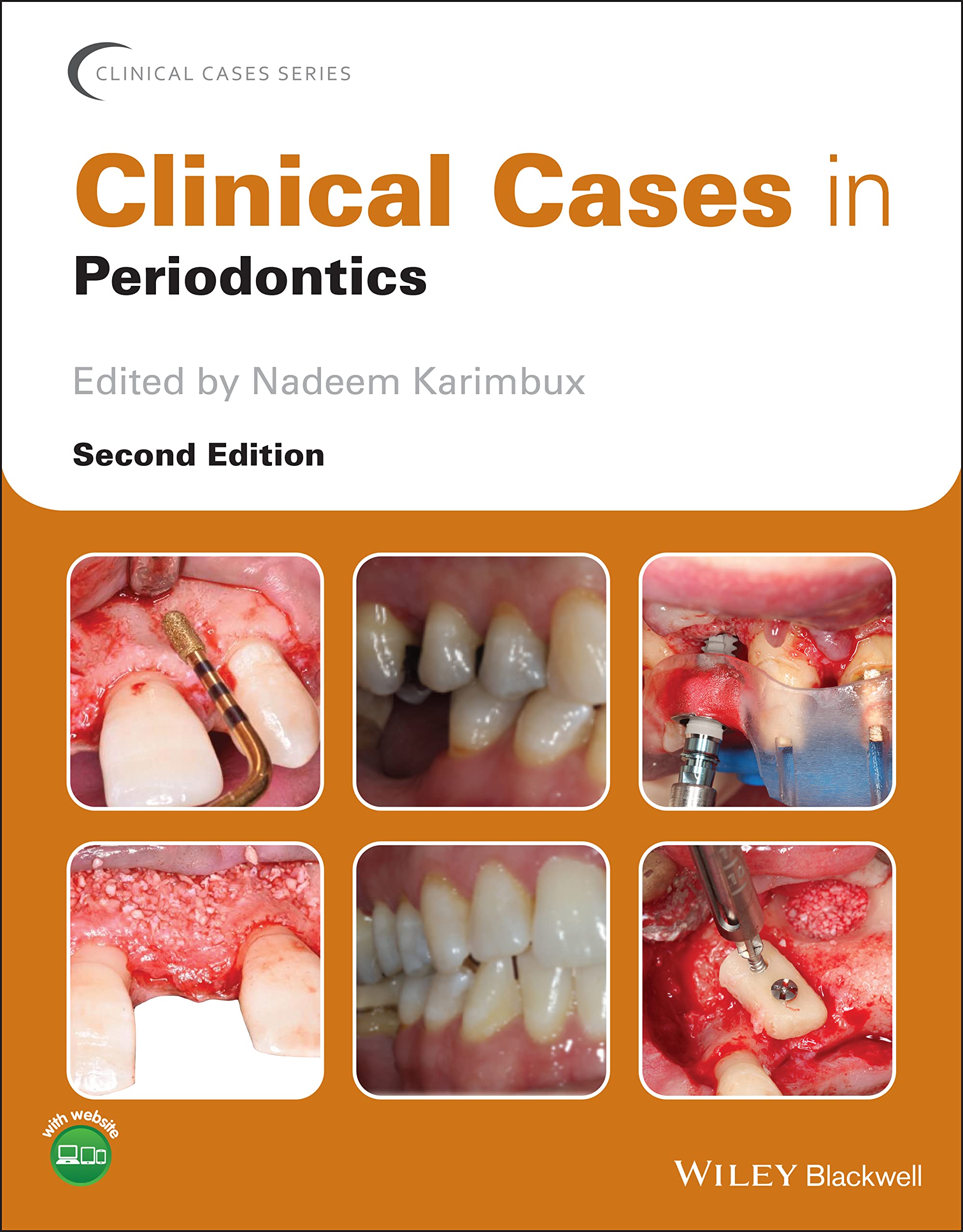 Clinical Cases in Periodontics (PDF/EPUB Version)