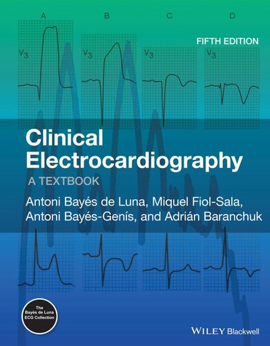 Clinical Electrocardiography: A Textbook (PDF/EPUB Version)