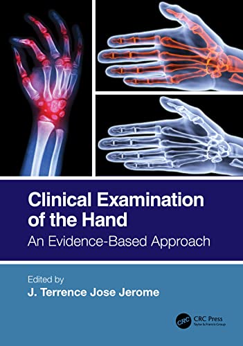 Clinical Examination of the Hand: An Evidence-Based Approach (PDF/EPUB Version)