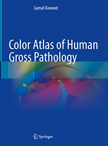 Color Atlas of Human Gross Pathology (PDF/EPUB Version)