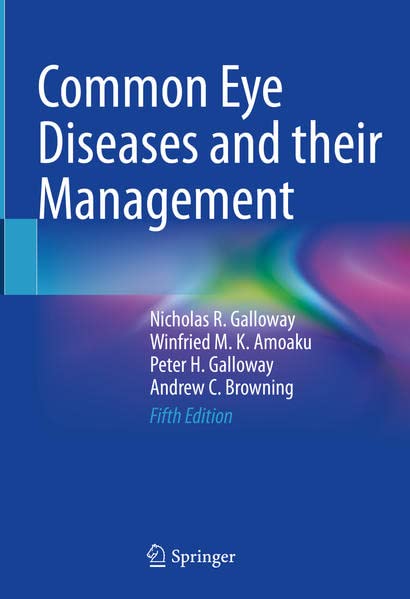 Common Eye Diseases and their Management (PDF/EPUB Version)