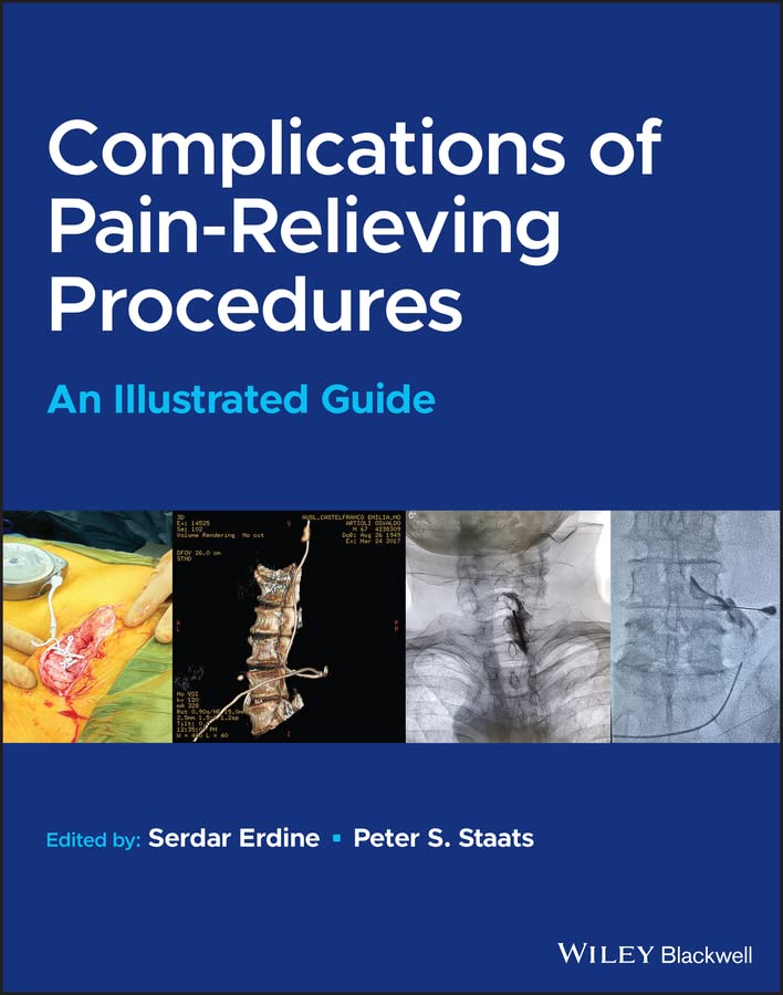 Complications of Pain-Relieving Procedures: An Illustrated Guide (PDF/EPUB Version)