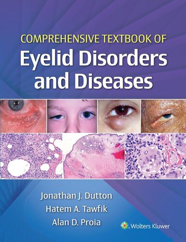 Comprehensive Textbook of Eyelid Disorders and Diseases (PDF/EPUB Version)