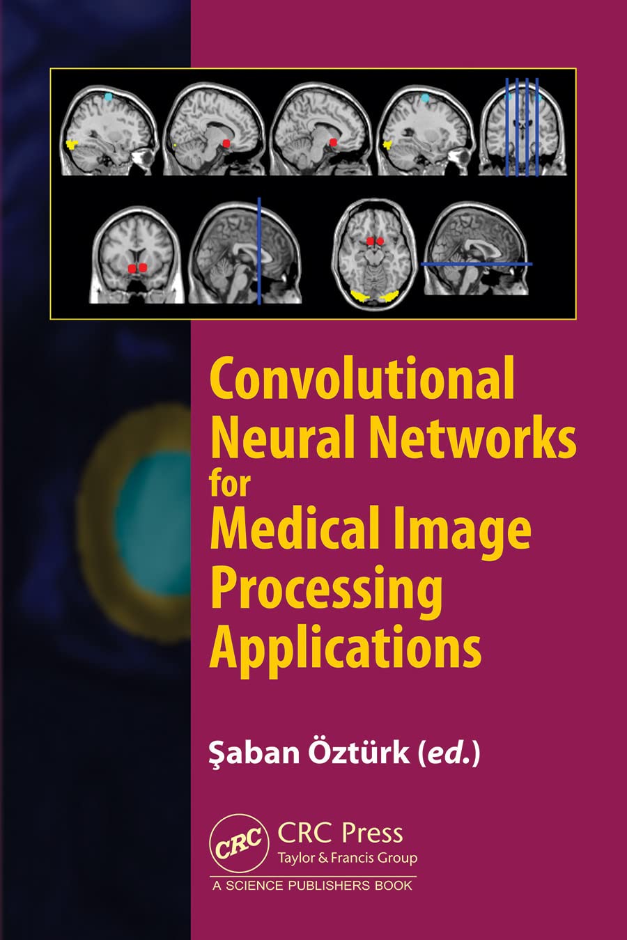 Convolutional Neural Networks for Medical Image Processing Applications (PDF/EPUB Version)