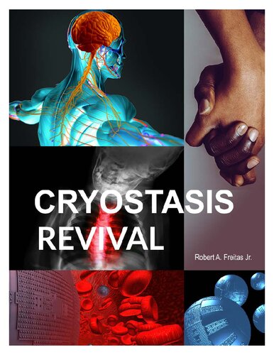 Cryostasis Revival: The Recovery of Cryonics Patients through Nanomedicine (PDF/EPUB Version)