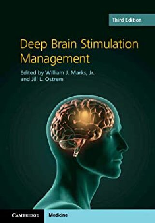 Deep brain stimulation management (PDF/EPUB Version)