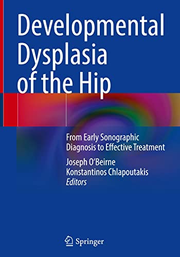 Developmental Dysplasia of the Hip: From Early Sonographic Diagnosis to Effective Treatment (PDF/EPUB Version)