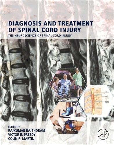 Diagnosis and Treatment of Spinal Cord Injury (PDF/EPUB Version)