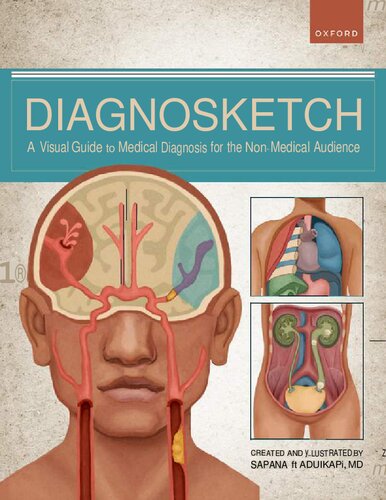 Diagnosketch: A Visual Guide to Medical Diagnosis for the Non-Medical Audience 2022 (PDF/EPUB Version)
