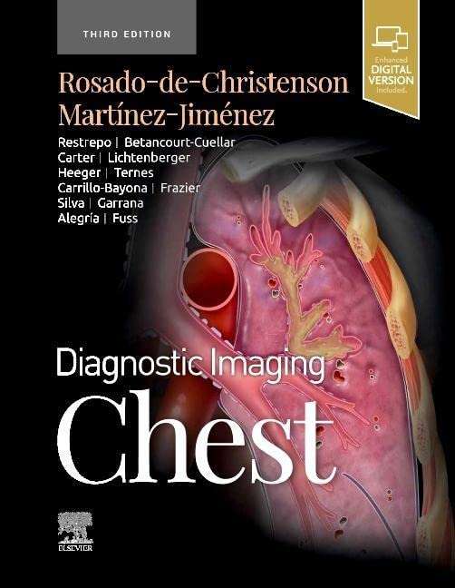 Diagnostic Imaging: Chest (PDF/EPUB Version)