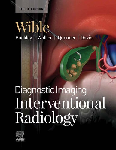 Diagnostic Imaging: Interventional Radiology (PDF/EPUB Version)