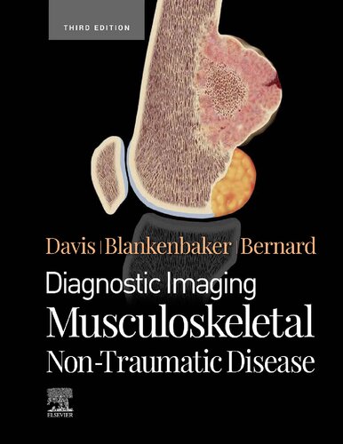 Diagnostic Imaging: Musculoskeletal Non-Traumatic Disease (PDF/EPUB Version)