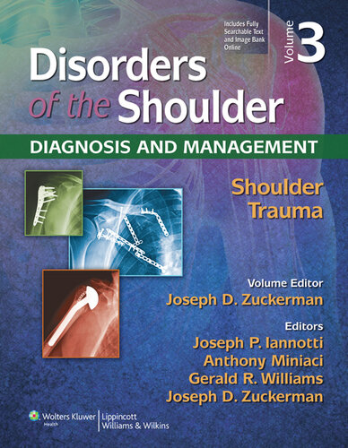 Disorders of the Shoulder: Trauma (PDF/EPUB Version)