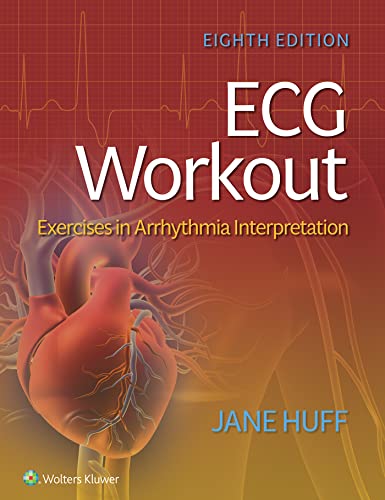 ECG Workout: Exercises in Arrhythmia Interpretation (PDF/EPUB Version)