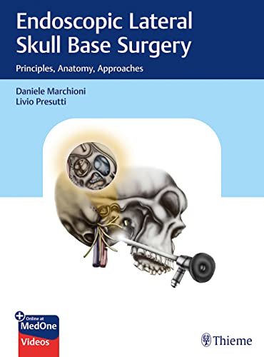 Endoscopic Lateral Skull Base Surgery: Principles, Anatomy, Approaches (PDF/EPUB Version)