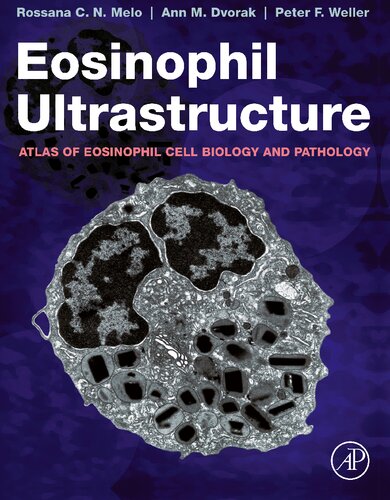 Eosinophil Ultrastructure: Atlas of Eosinophil Cell Biology and Pathology (PDF/EPUB Version)