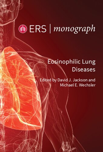 Eosinophilic Lung Disease (PDF/EPUB Version)