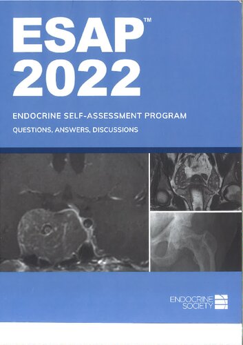 ESAP 2022: Endocrine Society's Endocrine Self-Assessment Program: Questions, Answers, Discussions (PDF/EPUB Version)