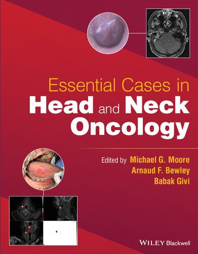 Essential Cases in Head and Neck Oncology (PDF/EPUB Version)