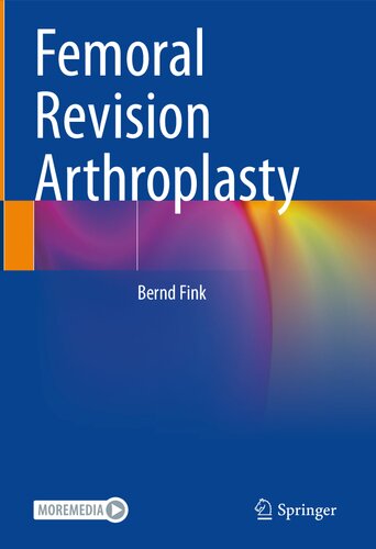 Femoral Revision Arthroplasty (PDF/EPUB Version)