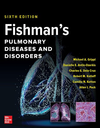 Fishman's Pulmonary Diseases and Disorders, 2-Volume Set (PDF/EPUB Version)