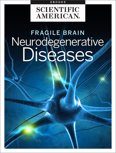 Fragile Brain: Neurodegenerative Diseases (PDF/EPUB Version)