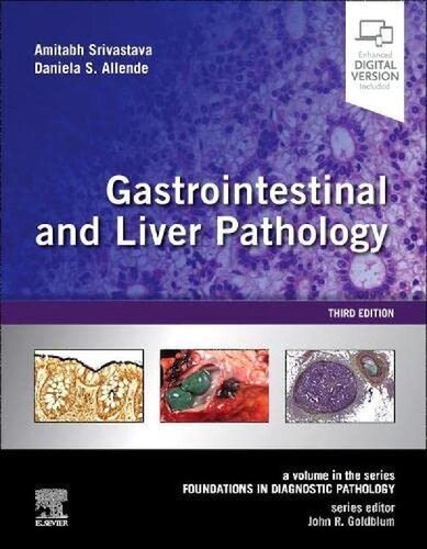 Gastrointestinal and Liver Pathology: A Volume in the Series: Foundations in Diagnostic Pathology (PDF/EPUB Version)