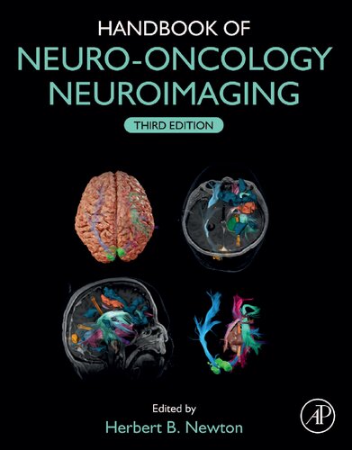 Handbook of Neuro-Oncology Neuroimaging (PDF/EPUB Version)