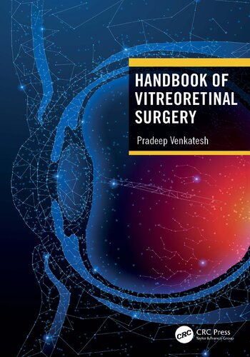 Handbook of Vitreoretinal Surgery (PDF/EPUB Version)
