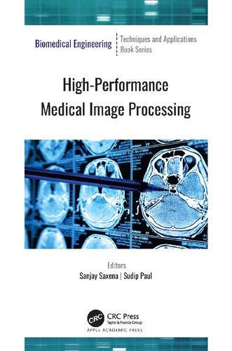 High-Performance Medical Image Processing (PDF/EPUB Version)