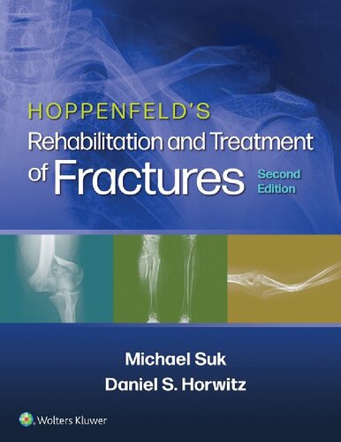 Hoppenfeld's treatment and rehabilitation of fractures (PDF/EPUB Version)