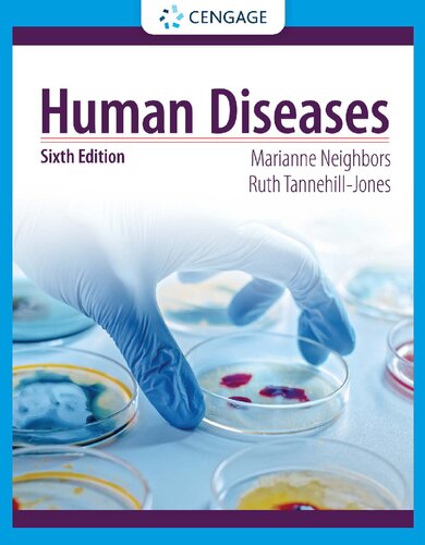 Human Diseases (MindTap Course List) (by Team-IRA) (PDF/EPUB Version)