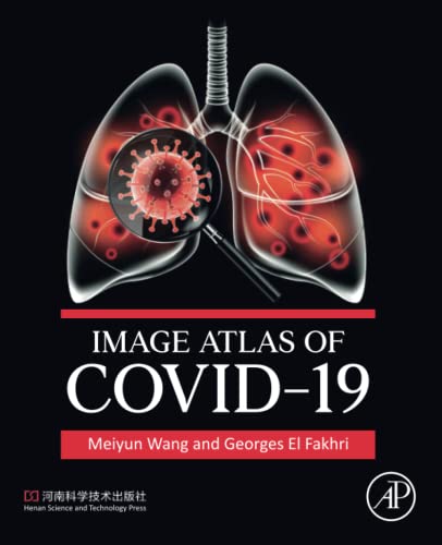 Image Atlas of COVID-19 (PDF/EPUB Version)
