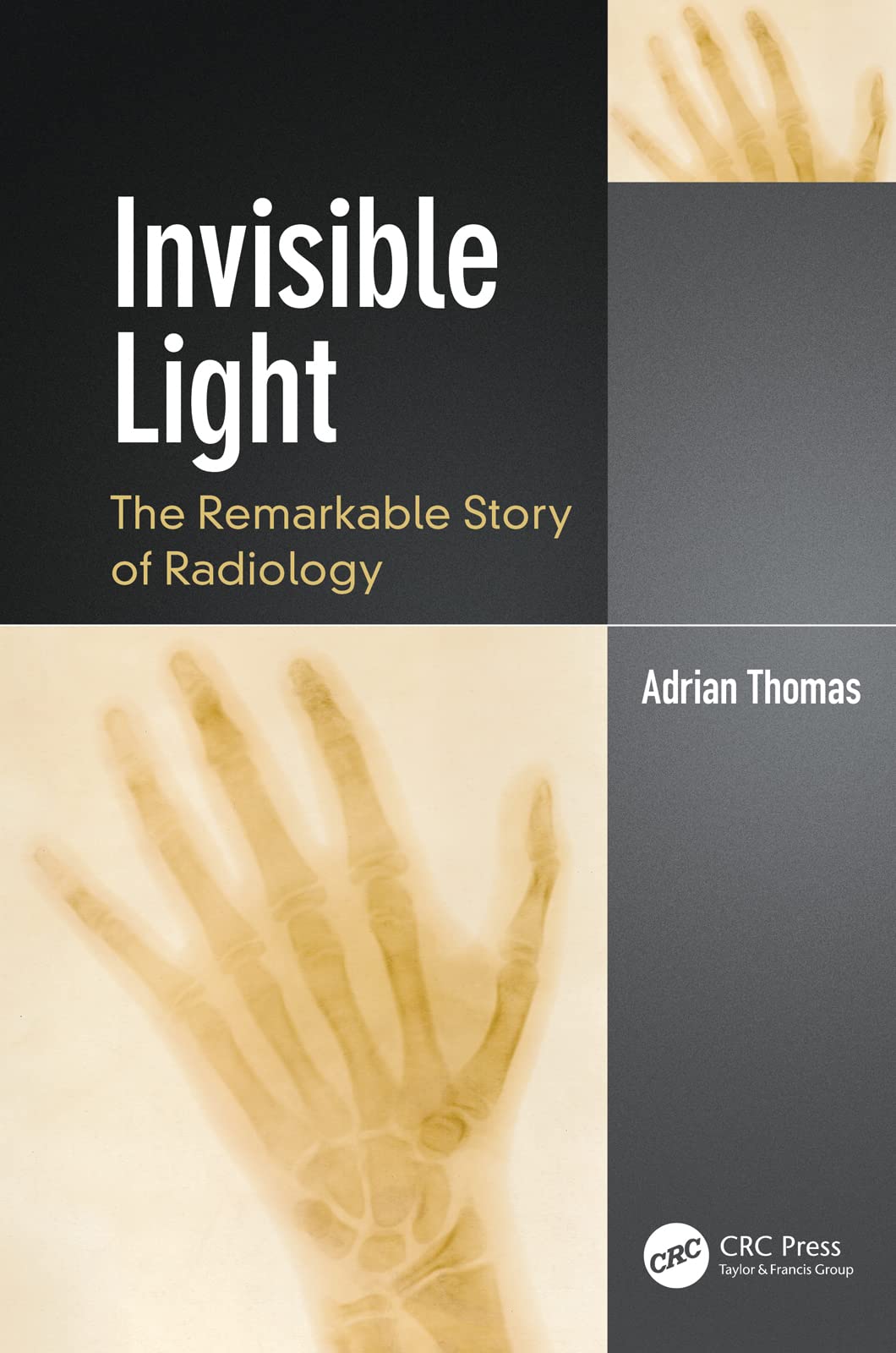 Invisible Light: The Remarkable Story of Radiology (PDF/EPUB Version)