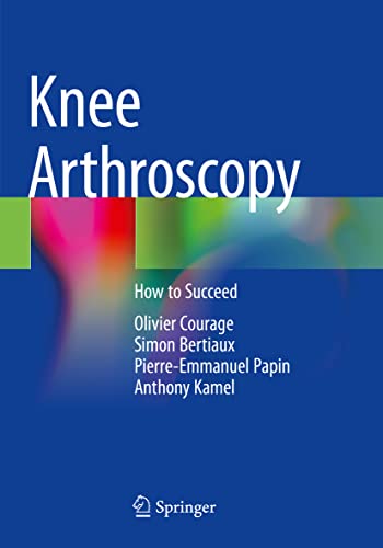 Knee Arthroscopy: How to Succeed (PDF/EPUB Version)