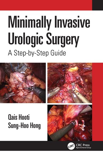 Minimally Invasive Urologic Surgery: A Step-by-Step Guide (PDF/EPUB Version)