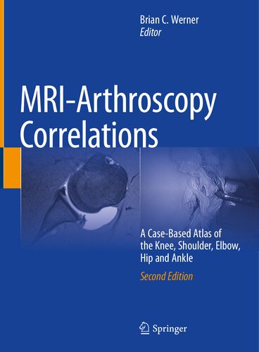 MRI-ARTHROSCOPY CORRELATIONS a case-based atlas of the knee, shoulder. (PDF/EPUB Version)