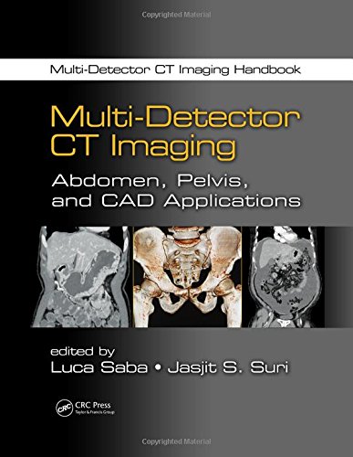 Multi-Detector CT Imaging Handbook, Two Volume Set (PDF/EPUB Version)