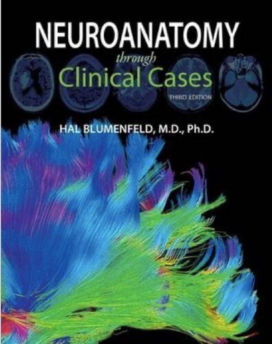 Neuroanatomy through Clinical Case (PDF/EPUB Version)