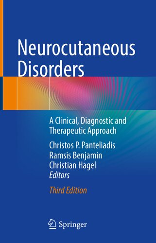 Neurocutaneous Disorders: A Clinical, Diagnostic and Therapeutic Approach (PDF/EPUB Version)
