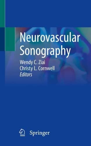 Neurovascular Sonography (PDF/EPUB Version)